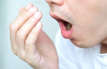 agiz-kokusu-nereden-kaynaklanir-gunluk-bakim-ile-azaltilabilir-mi Ağız kokusunun ağız içi ve genel nedenlerini, günlük ağız bakımının önemini gösteren bilgilendirici görsel.