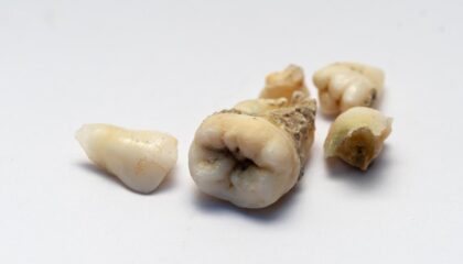 Çocuklarda diş çürüğünün nedenlerini ve ağız bakımında ailelerin dikkat etmesi gerekenleri anlatan bilgilendirici görsel.