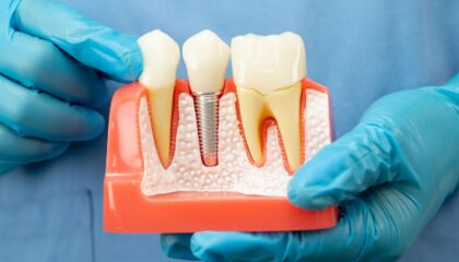 İmplant tedavisinin uygun olmadığı durumları ve çene kemiği ile genel sağlık ilişkisini gösteren bilgilendirici görsel.