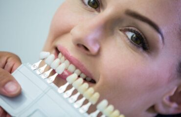 Zirkonyum ve porselen kaplamaların diş üzerindeki görünüm farklarını ve estetik özelliklerini karşılaştıran bilgilendirici görsel.