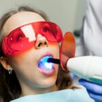 Diş beyazlatma işlemi sırasında diş rengindeki değişimi ve estetik gülüş görünümünü gösteren bilgilendirici görsel.