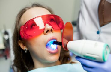 Diş beyazlatma işlemi sırasında diş rengindeki değişimi ve estetik gülüş görünümünü gösteren bilgilendirici görsel.