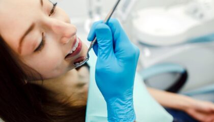 All-on-4 ve All-on-6 implant sistemleriyle sabit protez uygulamasını gösteren çene modeli görseli.