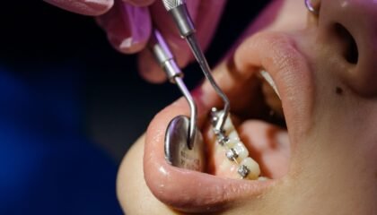 Ortodontik muayene sırasında diş dizilimi ve diş teli planlamasını değerlendiren diş hekimi.