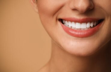 dis-eti-seviyesi-gulusu-nasil-etkiler Diş eti seviyeleri ve gülüş estetiğinin değerlendirildiği estetik diş hekimliği muayenesi.
