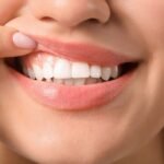 Konya’da diş eti kanaması ve periodontal dokuların değerlendirildiği ayrıntılı diş hekimi muayenesi.