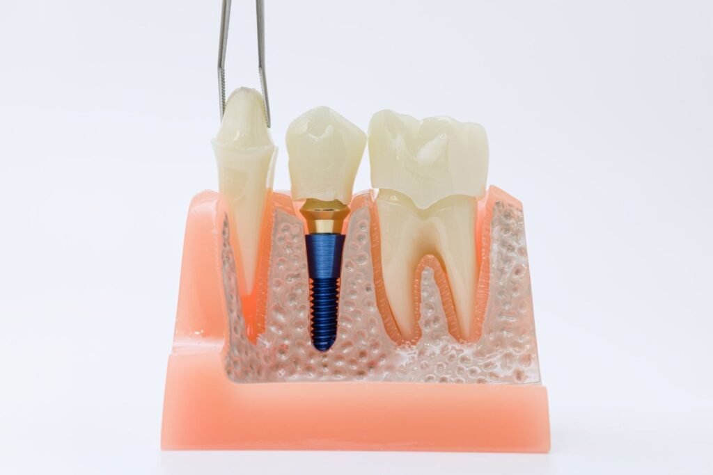 İmplant çevresi dokuların periodontal açıdan değerlendirildiği diş hekimliği muayenesi.