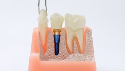 İmplant çevresi dokuların periodontal açıdan değerlendirildiği diş hekimliği muayenesi.