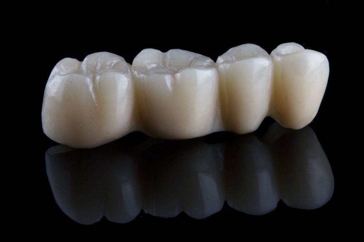 Konya sabit diş protezi hangi durumlarda değerlendirilir? Kron, köprü ve implant üstü protezlerin kullanım alanları hakkında bilgilendirici içerik.