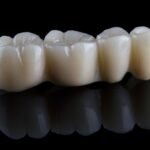 Konya sabit diş protezi hangi durumlarda değerlendirilir? Kron, köprü ve implant üstü protezlerin kullanım alanları hakkında bilgilendirici içerik.